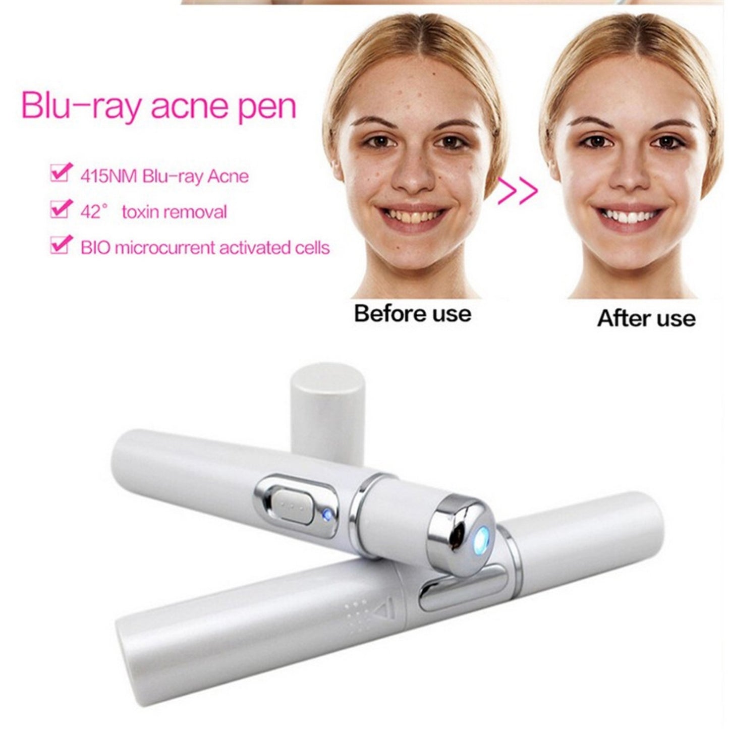 Blue Light Therapy Acne Pen: Scar, Wrinkle Removal, Skin Care Device