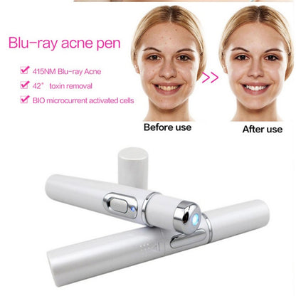 Blue Light Therapy Acne Pen: Scar, Wrinkle Removal, Skin Care Device