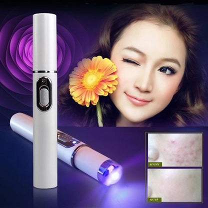 Blue Light Therapy Acne Pen: Scar, Wrinkle Removal, Skin Care Device