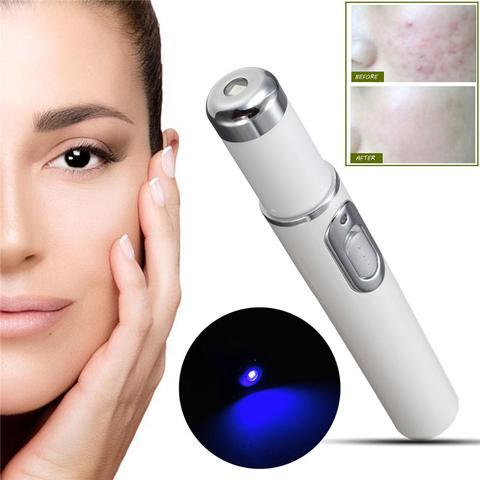 Blue Light Therapy Acne Pen: Scar, Wrinkle Removal, Skin Care Device