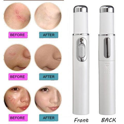 Blue Light Therapy Acne Pen: Scar, Wrinkle Removal, Skin Care Device